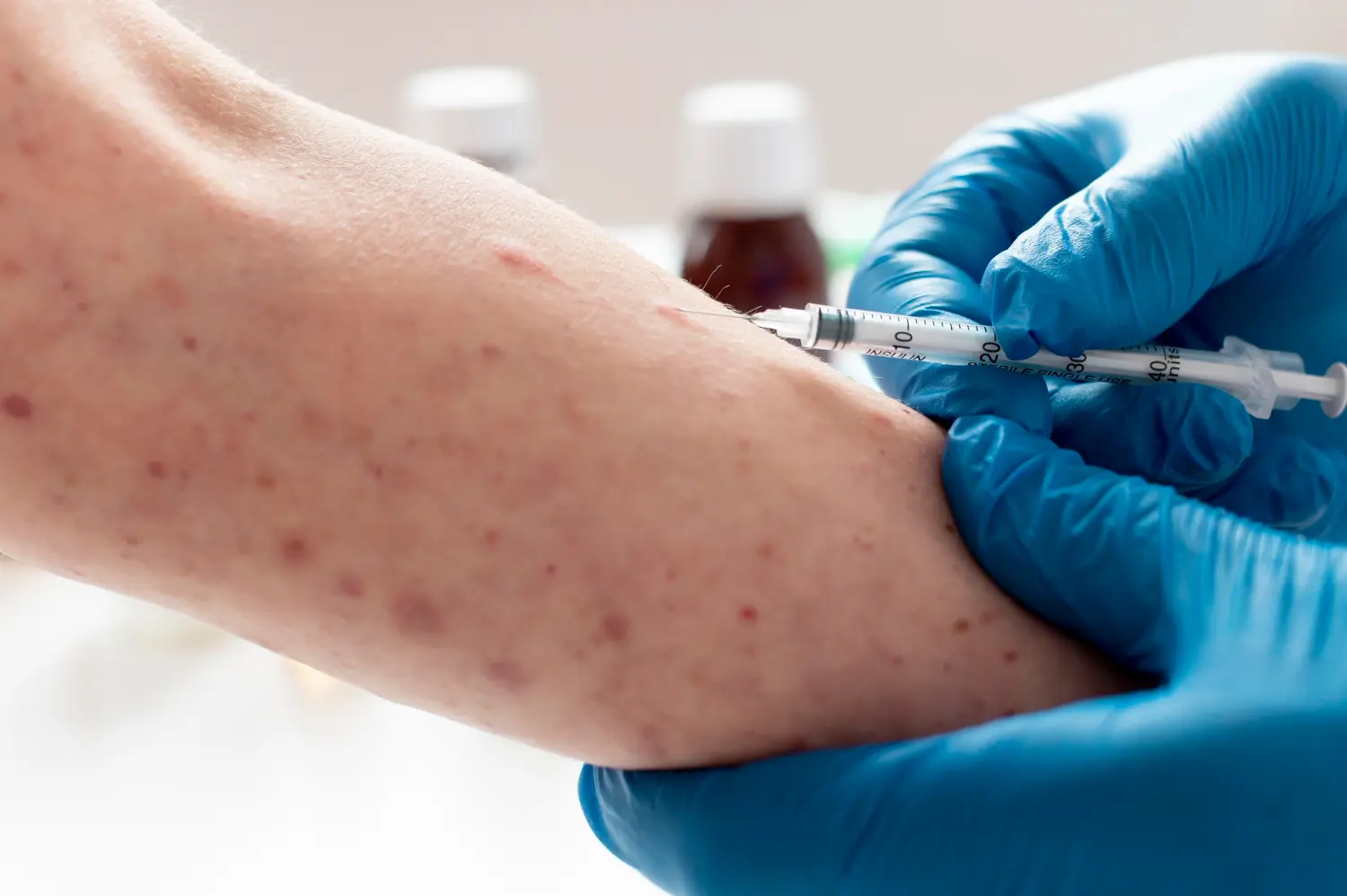 تحليل rubella igG النسبة الطبيعية ولماذا هو مهم قبل الحمل؟