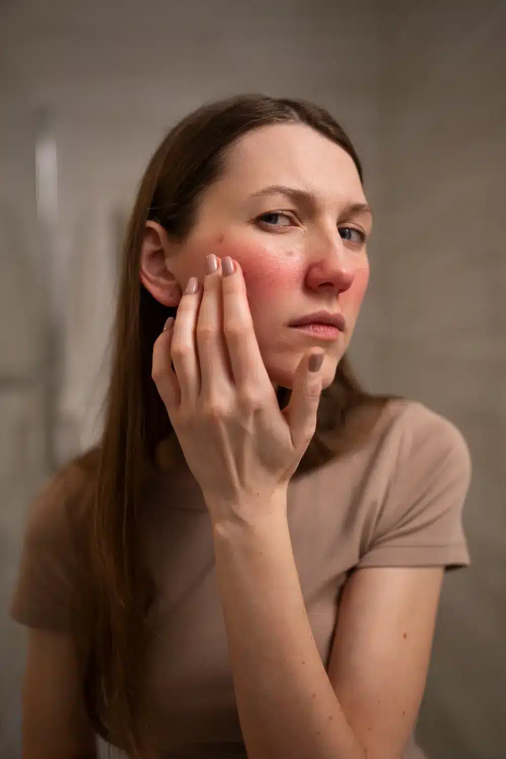 متى تظهر نتائج Roaccutane على البشرة؟ جدول زمني وتحذيرات مهمة قبل الاستخدام