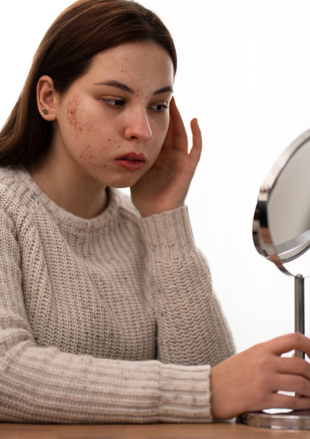 متى تظهر نتائج Roaccutane على البشرة؟ جدول زمني وتحذيرات مهمة قبل الاستخدام