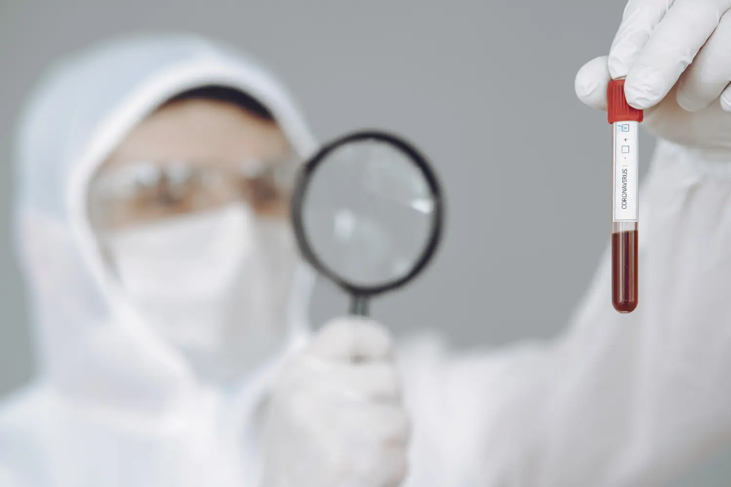 متى تطلع نتيجة مسحة عنق الرحم؟ دليل شامل لزمن الفحص وتفسير النتائج