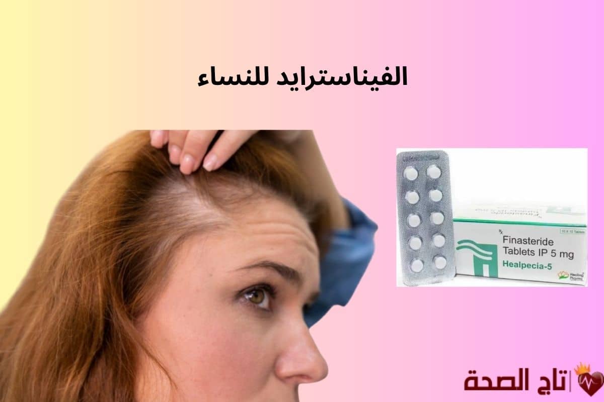 الفيناسترايد للنساء: الفوائد، الأضرار، والبدائل الآمنة لتساقط الشعر