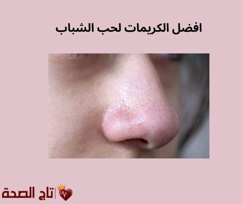 افضل الكريمات لحب الشباب: دليلك لاختيار العلاج الأمثل لبشرة صافية
