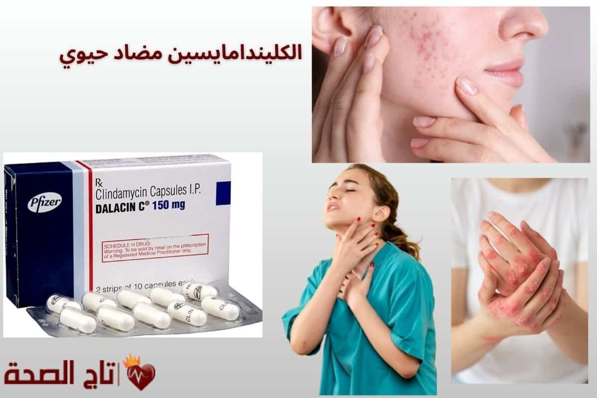 الكليندامايسين مضاد حيوي: أسرار الفعالية، الأعراض الجانبية، ونصائح الأطباء