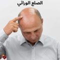 الصلع الوراثي: أسبابه وأعراضه وطرق العلاج الحديثة لاستعادة ثقتك