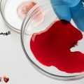 فقر الدم